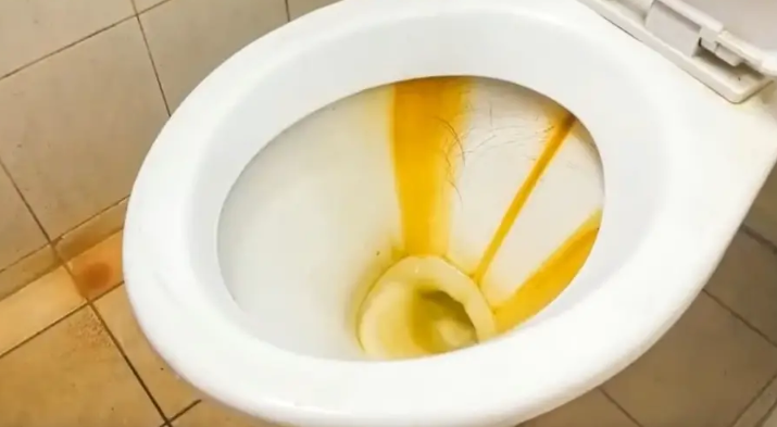 Air Toilet Kuning
